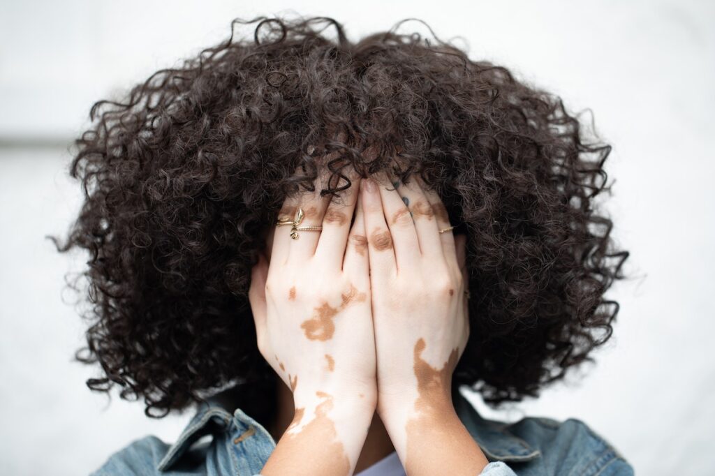 Image of a woman of color covering her face. Showing the importance of getting support from black female therapy in Atlanta. If you want to empbrace your authentic self then therapy for women of color with a black female therapist in Atlanta, GA can help!